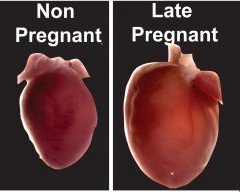  تغییرات قلب و عروق در بارداری